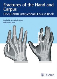 Cover image for Fractures of the Hand and Carpus: FESSH 2018 Instructional Course Book