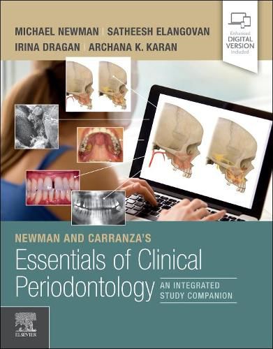 Cover image for Newman and Carranza's Essentials of Clinical Periodontology: An Integrated Study Companion