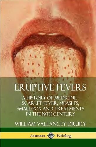 Cover image for Eruptive Fevers: A History of Medicine - Scarlet Fever, Measles, Small-Pox and Treatments in the 19th Century (Hardcover)