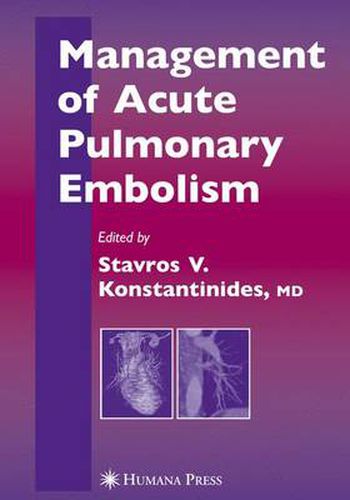 Cover image for Management of Acute Pulmonary Embolism