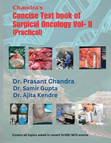 Cover image for Chandra's Concise Text book of Surgical Oncology Vol- II(Practical)
