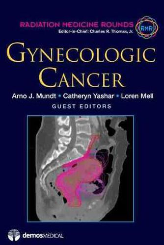 Cover image for Gynecologic Cancer