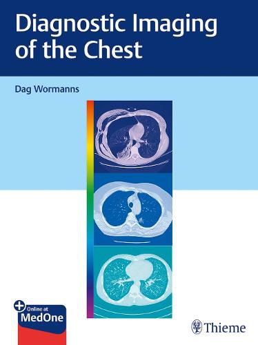 Cover image for Diagnostic Imaging of the Chest