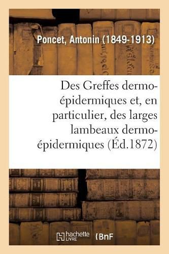 Cover image for Des Greffes Dermo-Epidermiques Et, En Particulier, Des Larges Lambeaux Dermo-Epidermiques