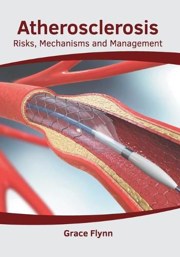 Cover image for Atherosclerosis: Risks, Mechanisms and Management
