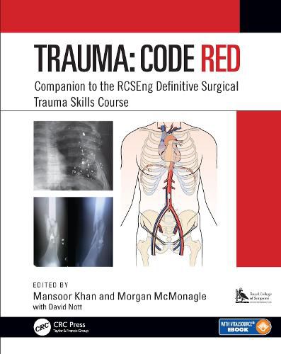 Cover image for Trauma: Code Red: Companion to the RCSEng Definitive Surgical Trauma Skills Course