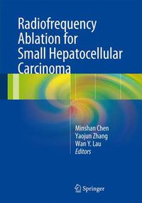 Cover image for Radiofrequency Ablation for Small Hepatocellular Carcinoma