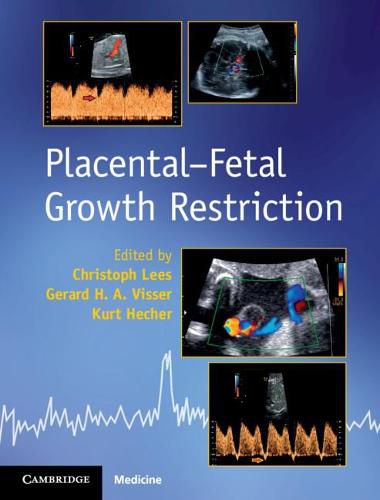 Cover image for Placental-Fetal Growth Restriction