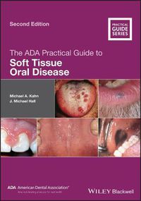 Cover image for The ADA Practical Guide to Soft Tissue Oral Disease 2e