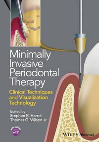 Cover image for Minimally Invasive Periodontal Therapy: Clinical Techniques and Visualization Technology