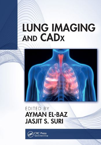 Cover image for Lung Imaging and CADx