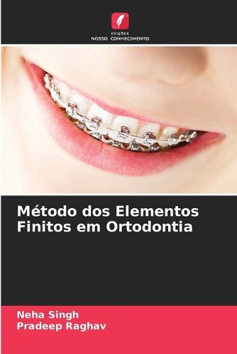 Cover image for Metodo dos Elementos Finitos em Ortodontia
