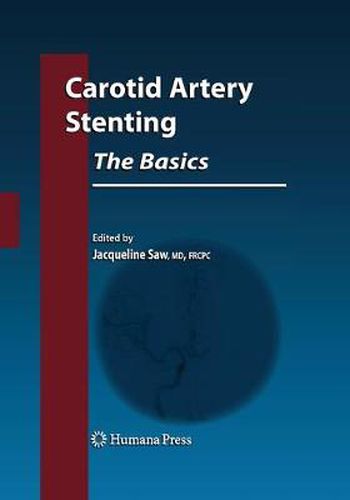 Cover image for Carotid Artery Stenting: The Basics