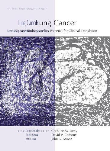 Cover image for Lung Cancer: Disease Biology and Its Potential for Clinical Translation