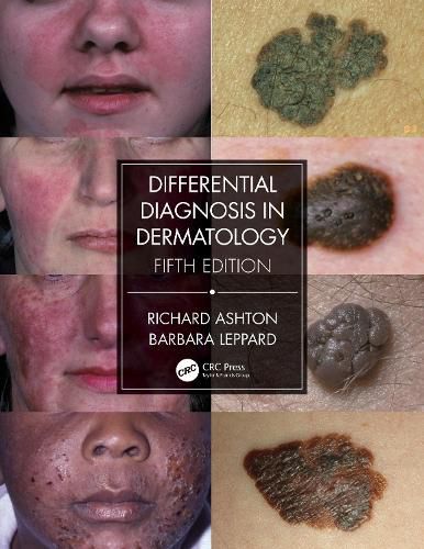 Cover image for Differential Diagnosis in Dermatology