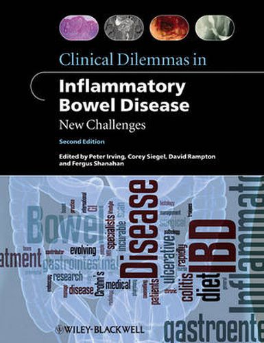 Clinical Dilemmas in Inflammatory Bowel Disease: New Challenges