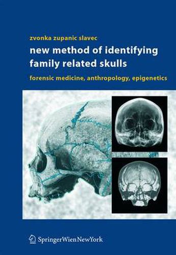 Cover image for New Method of Identifying Family Related Skulls: Forensic Medicine, Anthropology, Epigenetics