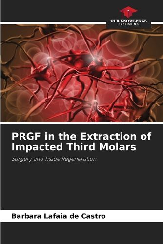 Cover image for PRGF in the Extraction of Impacted Third Molars