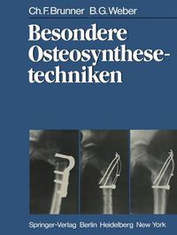 Cover image for Besondere Osteosynthesetechniken