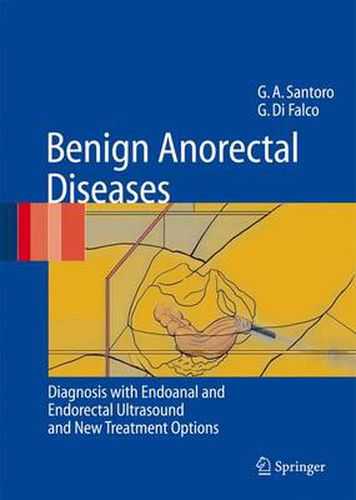 Cover image for Benign Anorectal Diseases: Diagnosis with Endoanal and Endorectal Ultrasound and New Treatment Options