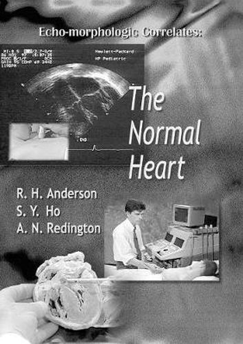 Echo-morphologic Correlates: The Normal Heart (With Video)