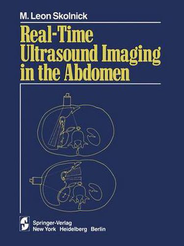 Cover image for Real-time Ultrasound Imaging in the Abdomen