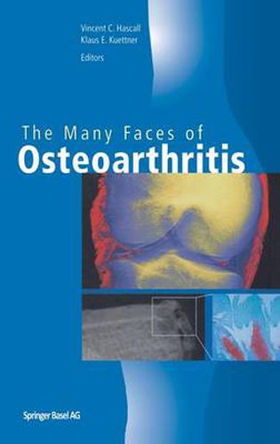 The Many Faces of Osteoarthritis