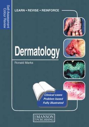 Cover image for Dermatology: Self-Assessment Colour Review