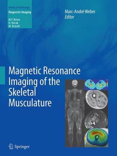 Cover image for Magnetic Resonance Imaging of the Skeletal Musculature