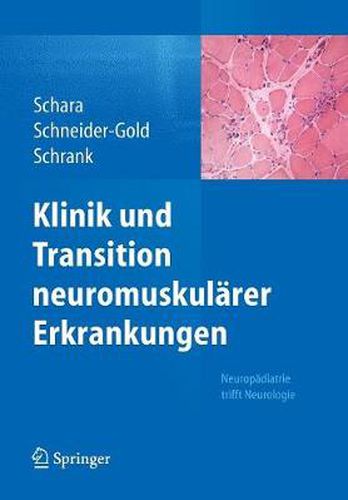 Klinik Und Transition Neuromuskularer Erkrankungen: Neuropadiatrie Trifft Neurologie