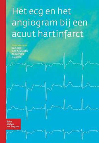 Cover image for Het ECG En Het Angiogram Bij Een Acuut Hartinfarct