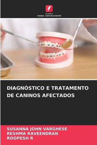 Cover image for Diagnostico E Tratamento de Caninos Afectados