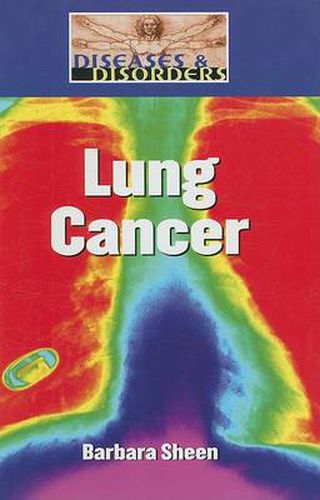 Lung Cancer