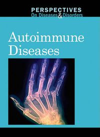 Cover image for Autoimmune Diseases