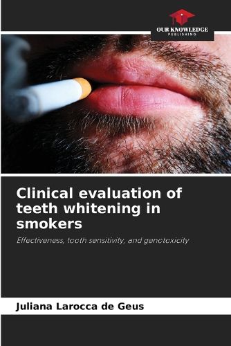 Cover image for Clinical evaluation of teeth whitening in smokers