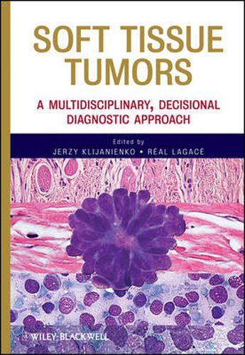 Cover image for Soft Tissue Tumors: A Multidisciplinary, Decisional Diagnostic Approach