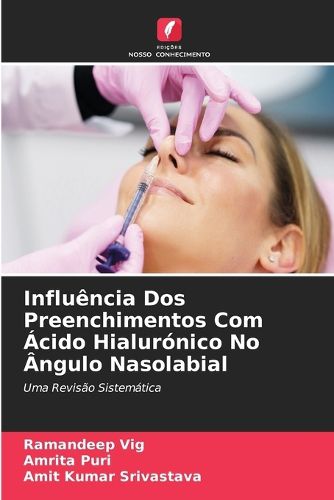 Cover image for Influencia Dos Preenchimentos Com Acido Hialuronico No Angulo Nasolabial
