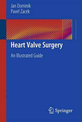 Cover image for Heart Valve Surgery: An Illustrated Guide