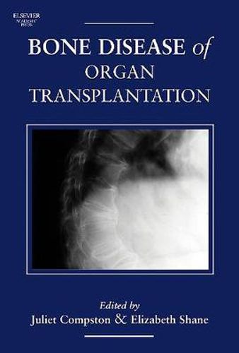 Cover image for Bone Disease of Organ Transplantation