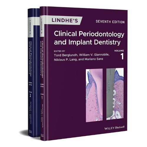 Cover image for Lindhe's Clinical Periodontology and Implant Dentistry: 2 Volume Set
