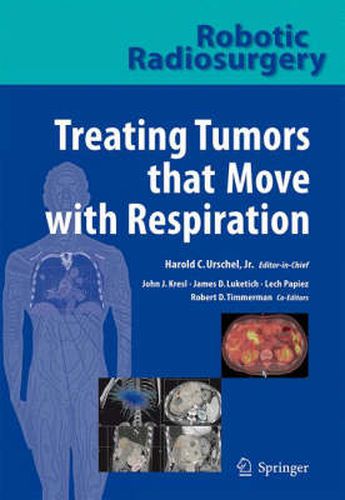 Cover image for Robotic Radiosurgery. Treating Tumors that Move with Respiration