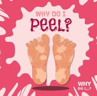 Cover image for Why Do I Peel?