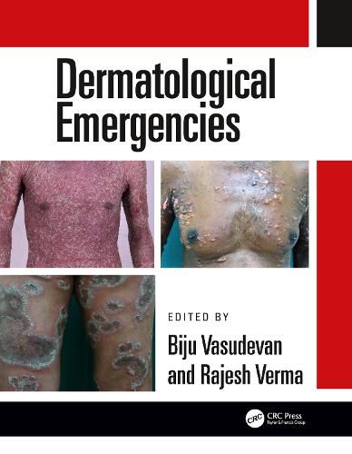 Cover image for Dermatological Emergencies