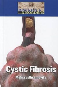 Cover image for Cystic Fibrosis