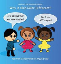 Cover image for Why Is Skin Color Different?