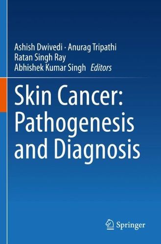 Cover image for Skin Cancer: Pathogenesis and Diagnosis