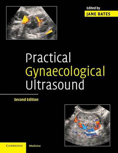 Cover image for Practical Gynaecological Ultrasound