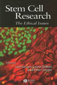 Cover image for Stem Cell Research: The Ethical Issues