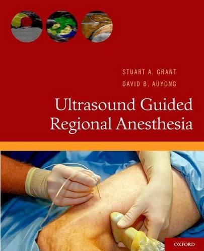 Cover image for Ultrasound Guided Regional Anesthesia