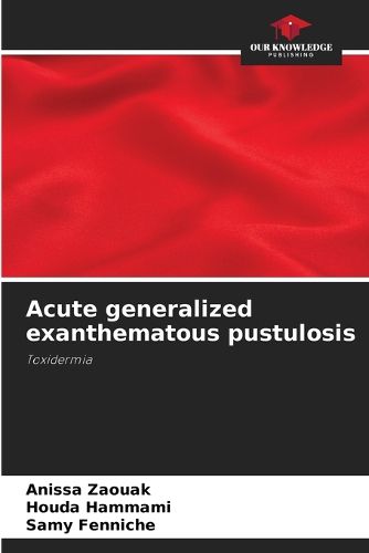 Cover image for Acute generalized exanthematous pustulosis